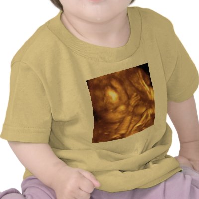 4D Ultrasound Tshirt by slinky789