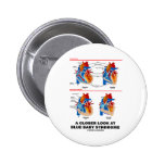 A Closer Look At Blue Baby Syndrome (Heart) Pins