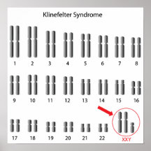 Affiche de syndrome de Klinefelter