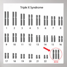 Affiche triple de syndrome de X