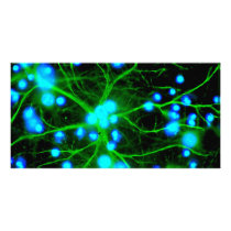 Astrocyte Are Star Shaped Glial Cells in the Brain Photo Card Template