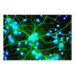 Astrocyte Are Star Shaped Glial Cells in the Brain