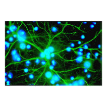 Astrocyte Are Star Shaped Glial Cells in the Brain Photo