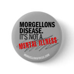 Awareness Button – Grey