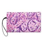 Awareness Wristlet
