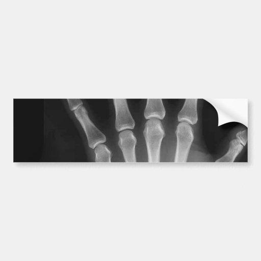 B&W X-ray Skeleton Hand Bumper Stickers