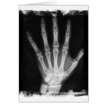 B&W X-ray Skeleton Hand Greeting Cards