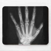 B&W X-ray Skeleton Hand Mousepad