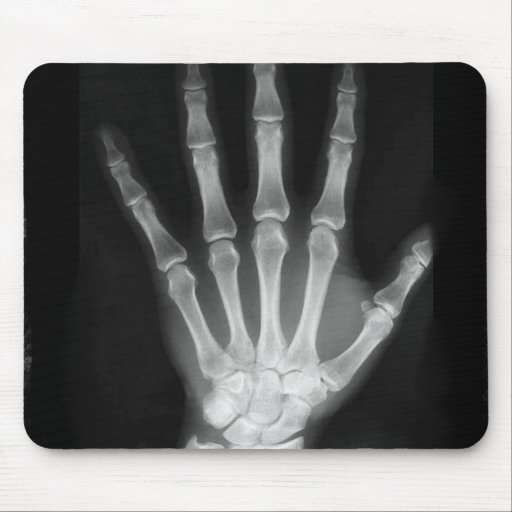 B&W X-ray Skeleton Hand Mousepad