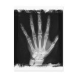 B&W X-ray Skeleton Hand