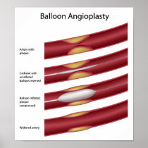 Balloon angioplasty procedure Poster