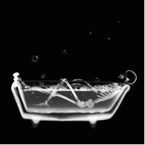 Bath Tub X-Ray Skeleton Black & White
