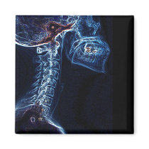 Blue C-spine X-ray square magnet
