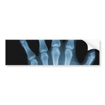 Blue X-ray Skeleton Hand