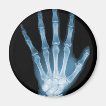 Blue X-ray Skeleton Hand Magnets