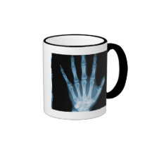 Blue X-ray Skeleton Hand Mug