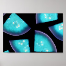 BlueWatermelon Posters