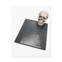 BonesXray061209 Post Card