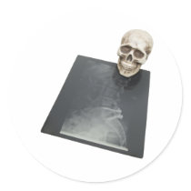 BonesXray061209 Round Stickers