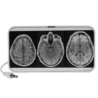 Brainophonic Pc Speakers by dwgodwin