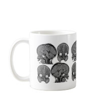 BRAINS! (MRI) COFFEE MUG