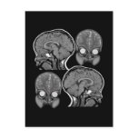 BRAINS! (MRI) POSTCARD