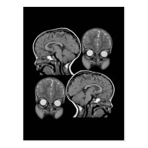 BRAINS! (MRI) POSTCARD