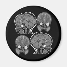 BRAINS! (MRI) REFRIGERATOR MAGNETS