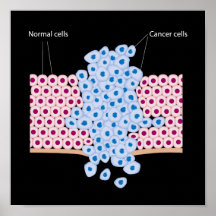 Cancer cells in a growing tumour Poster