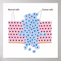Cancer cells in a growing tumour poster