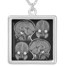 CERVEAUX ! Collier d'IRM