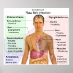 Chart of Symptoms of a Raw Fish Infection posters