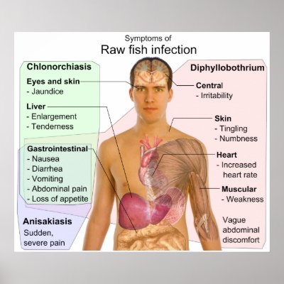 Chart of Symptoms of a Raw Fish Infection Posters by chartsanddiagrams