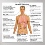 Chart of the Main Bacterial Infections in Humans posters