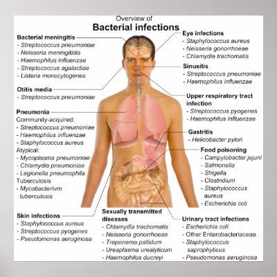 Chart of the Main Bacterial Infections in Humans Posters by chartsanddiagrams