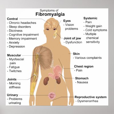Chart of the Symptoms of Fibromyalgia Posters by chartsanddiagrams