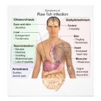 Chart of the Symptoms of Raw Fish Infection Art Photo