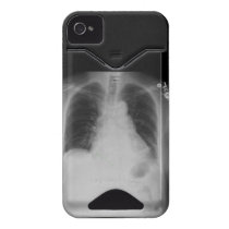 Chest X Ray ~ iPhone 4 CaseMate ID case