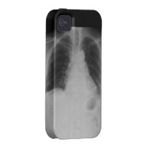 Chest X Ray ~ iPhone 4 CaseMate Tough case