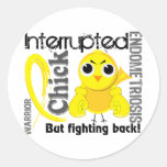 Chick Interrupted 3 Endometriosis Round Stickers