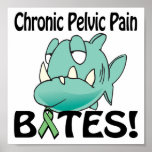 Chronic Pelvic Pain BITES posters
