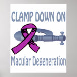 Clamp Down On Macular Degeneration Poster