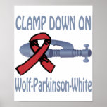 Clamp Down On Wolf-Parkinson-White Poster