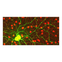 Close Up View of Retinal Ganglion Cell Photo Cards
