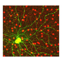 Close Up View of Retinal Ganglion Cell Photo Print