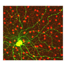 Close Up View of Retinal Ganglion Cell Photo Print