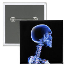 Close up x-ray of the bones in the neck buttons