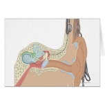 Cochlear Implants Greeting Cards