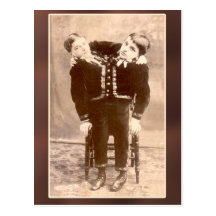 Conjoined Twins Vintage Cards and Postcards