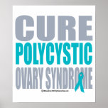 Cure PCOS posters